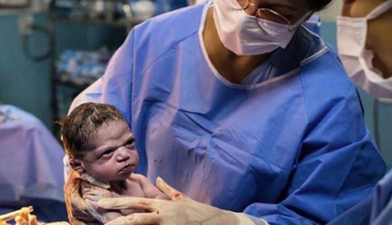 Bebé nasce com cara zangada e imagem torna-se viral